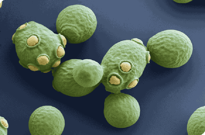 O que são leveduras? O que é Saccharomyces cerevisiae?